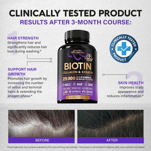 Biotin | Collagen | Keratin - 25000 Mcg Vitamins B2, B3, B6 & B7 + B1 & Hyaluronic Acid - Made in USA - Women & Men | 60 Capsules - Vitamen Store